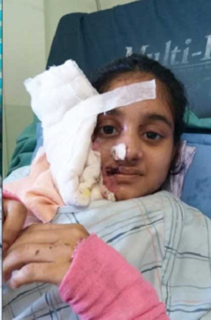 तेजाव पीडित मुस्कानको चिट्ठी प्रधानमन्त्रीलाई , “ विन्ती छ मेरो पीडा बुझिदिनुहोस् ”