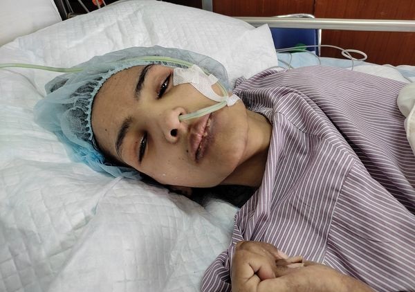 कलाकार निशा घिमिरे पूर्ण रुपमा स्वस्थ्य हुने संभावना कम रहेको अस्पतालद्धारा जानकारी