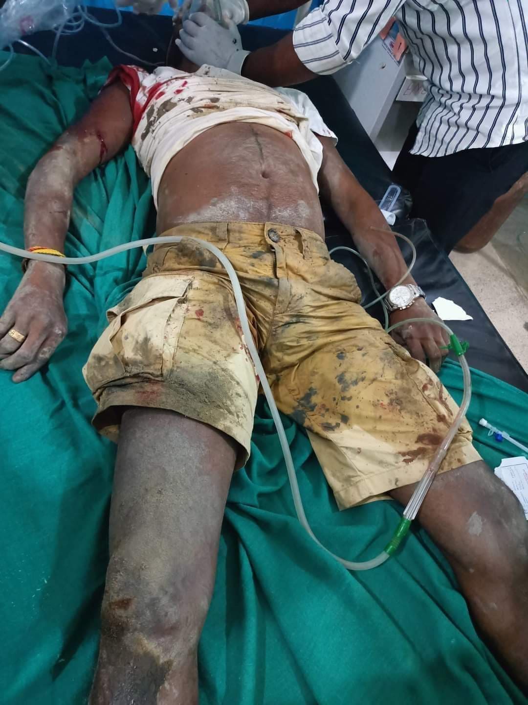 अज्ञात समुहद्धारा गोली हानी सर्लाहीमा एक भारतीय नागरिकको हत्या