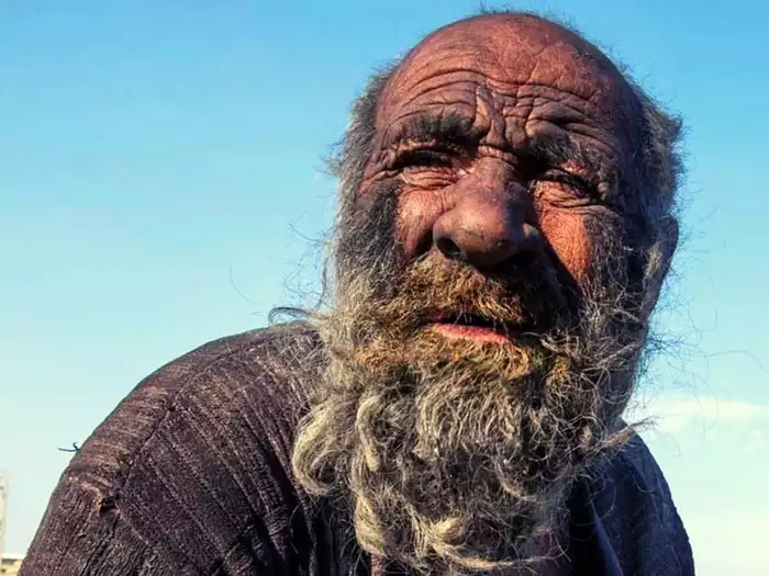 ५० वर्ष ननुहाएका संसारकै फोहोरी मान्छे, जुन दिन नुहाए त्यही दिन भयो मृत्यु