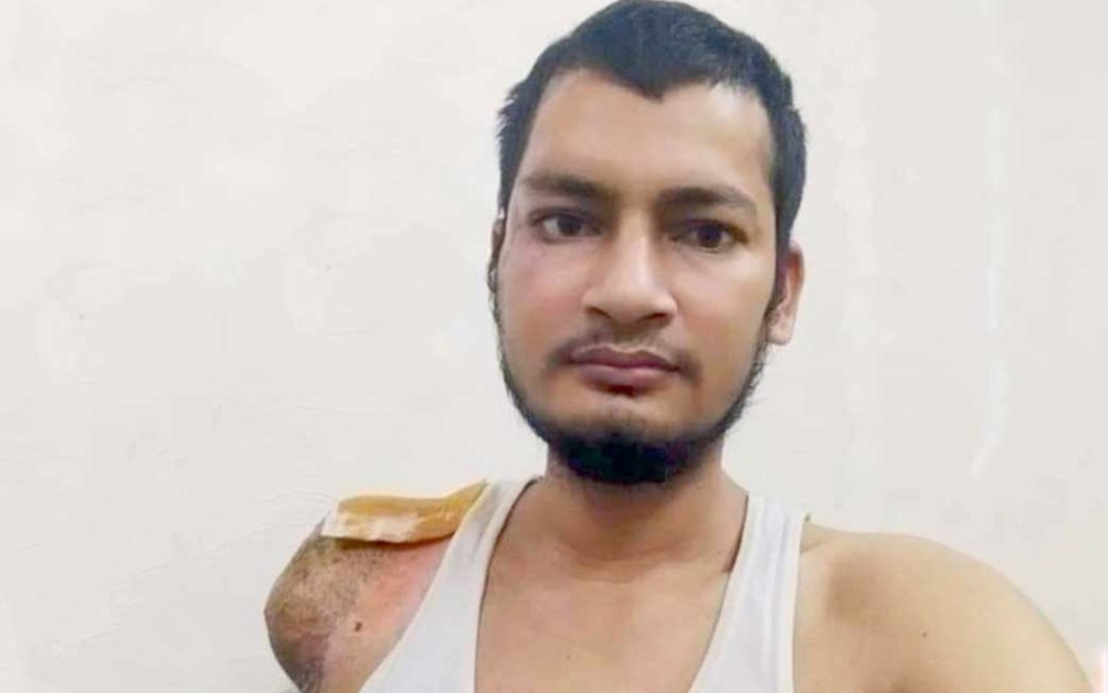 साउदीमा सवारी दुर्घटनामा परी हात गुमाएका हेमराज केसी स्वदेश फर्किए